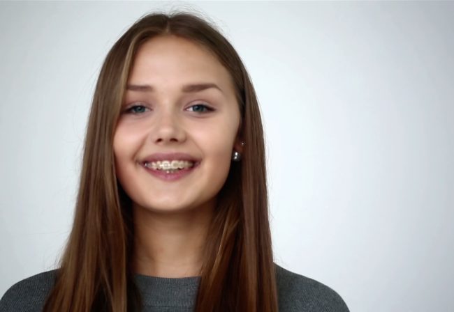 A girl with braces