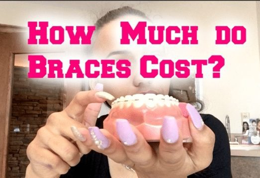 How Much Do Adult Braces Cost